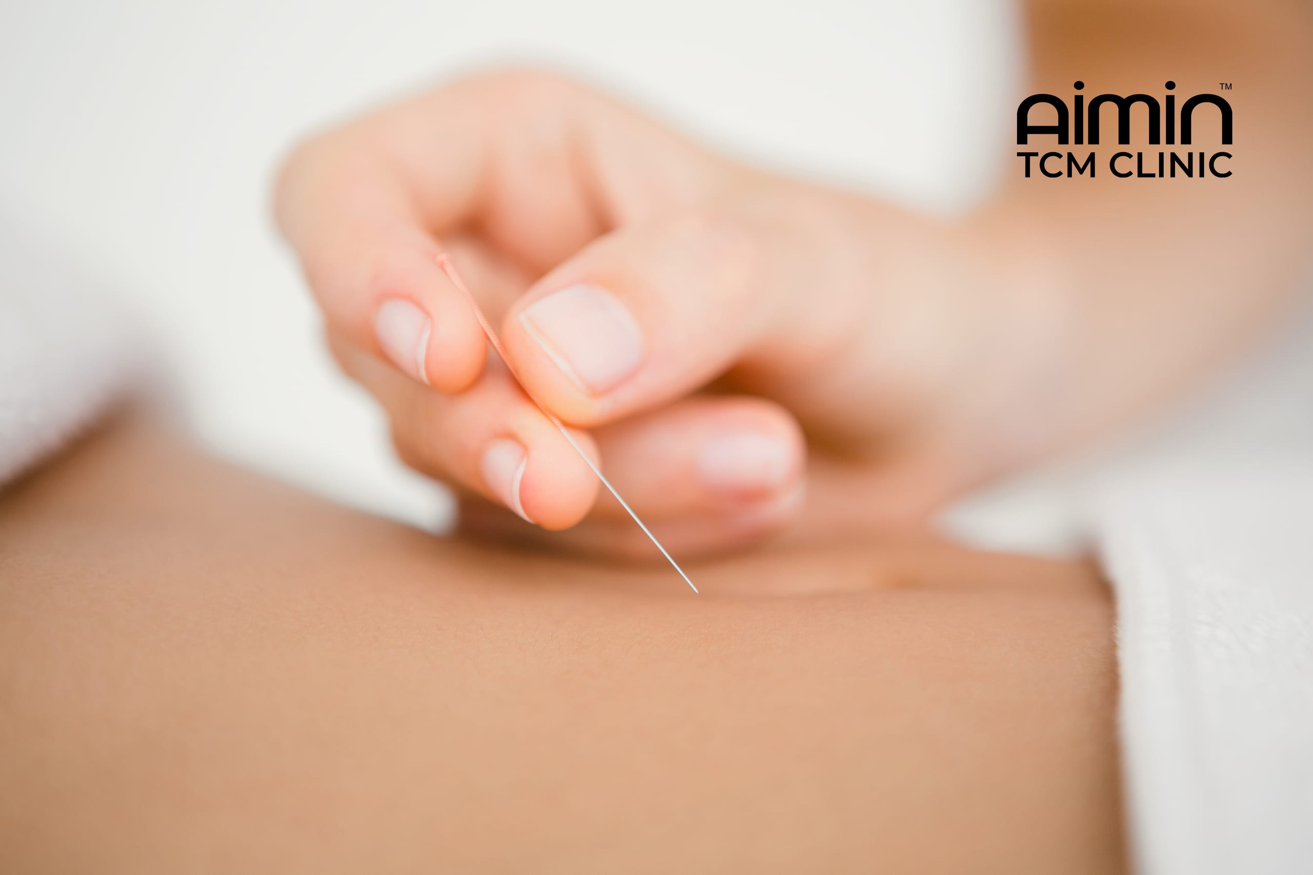 Acupuncture Treatment