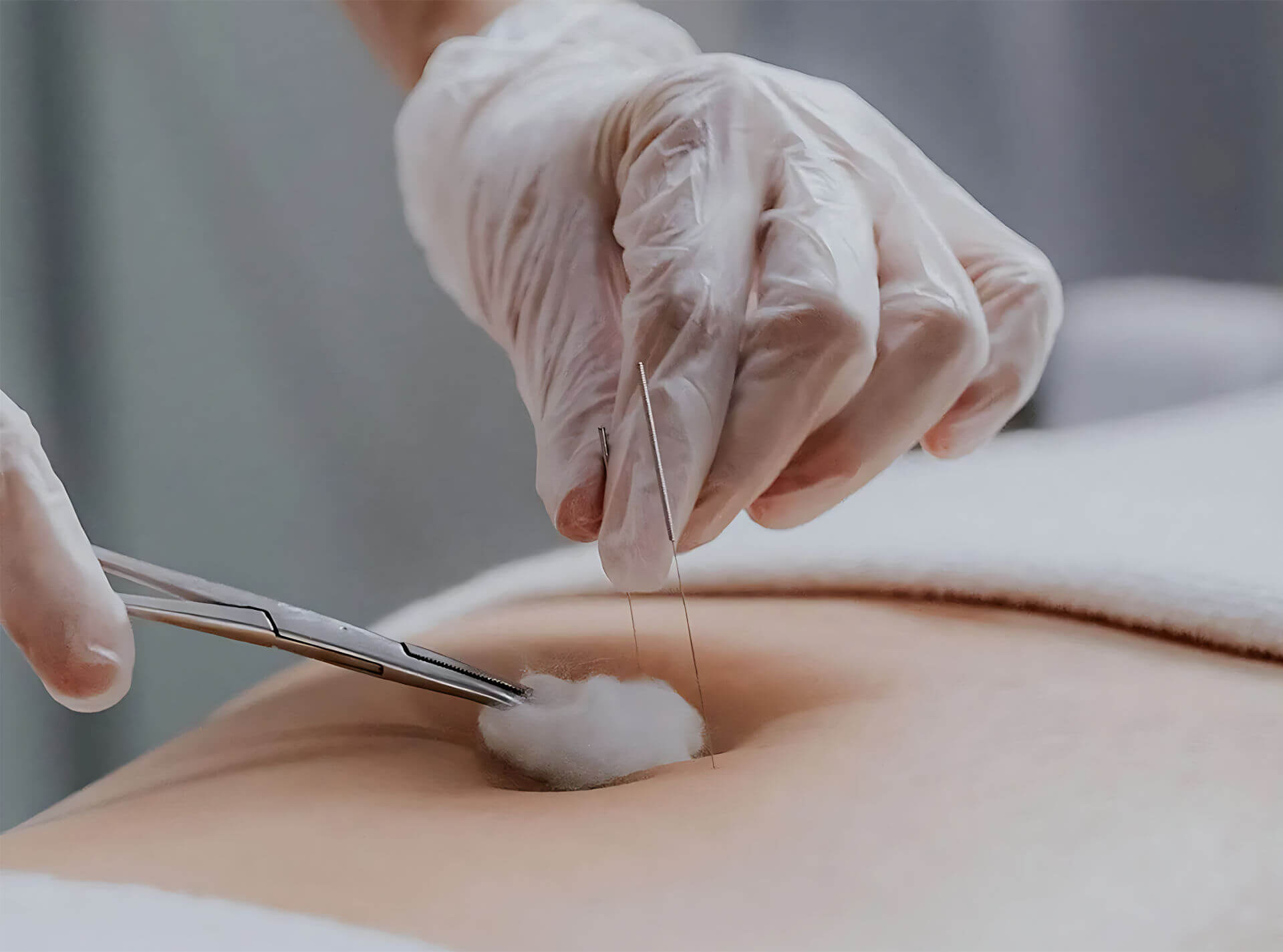 Aimin TCM Clinic Professional Treatment Room