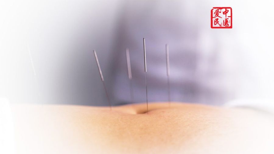 Treatment-Acupuncture
