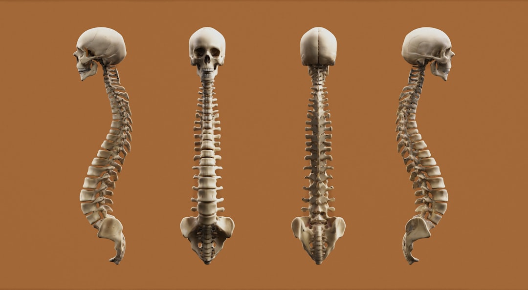 Lower body deformation caused by pelvic tilt